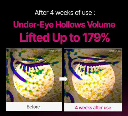 🔥LAST DAY 60% OFF!!VERELVA Korean Calcium Dark Spot Eye Cream