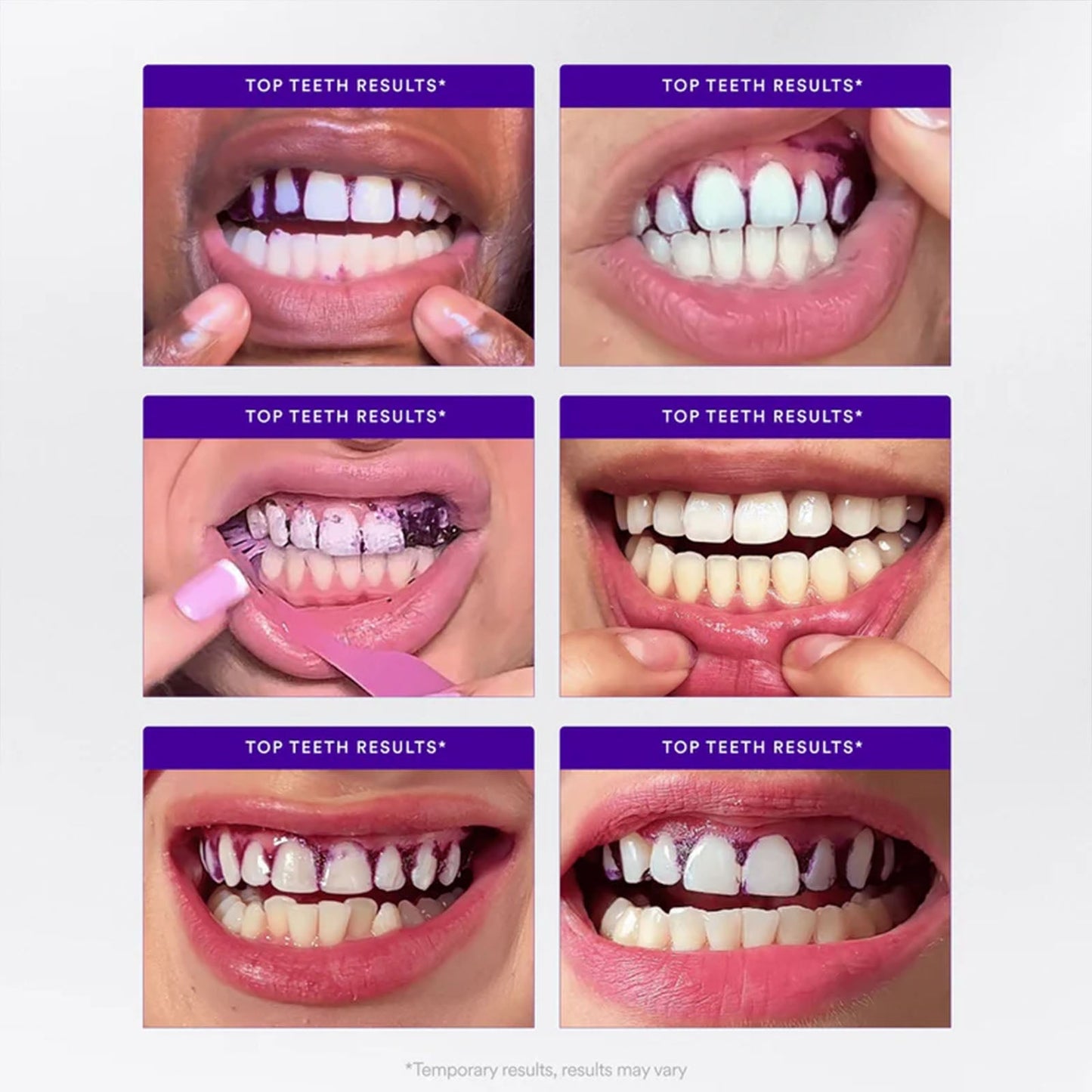 VERELVA™ Whitening Strips🦷 (🎁Flash Sale - Don’t Miss Out)