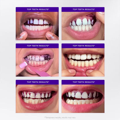 VERELVA™ Whitening Strips🦷 (🎁Flash Sale - Don’t Miss Out)