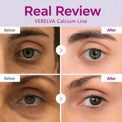 🔥LAST DAY 60% OFF!!VERELVA Korean Calcium Dark Spot Eye Cream